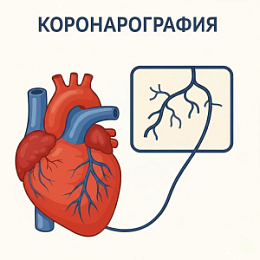 Коронарография сосудов сердца: что важно знать пациенту